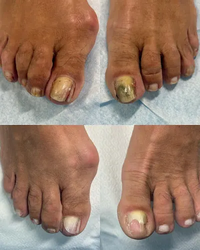 Zdrowe Nogi Gabinet Podologiczny